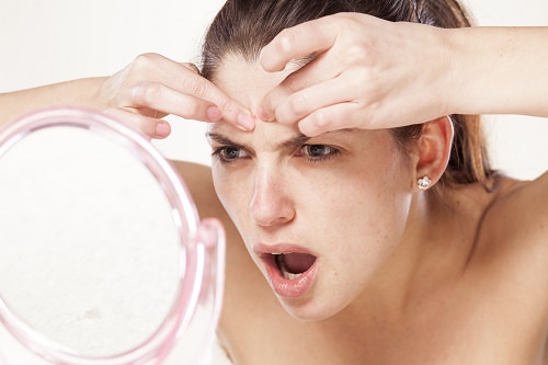 acne troubleshooting in Huntersville NC