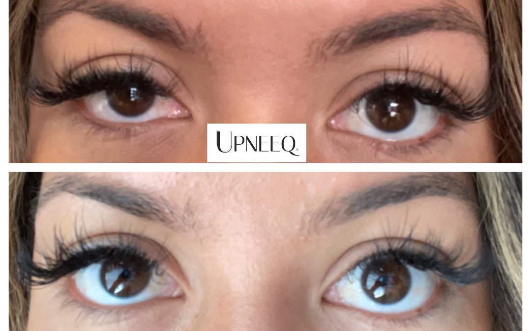 nonsurgical eyelid lift with upneeq